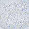 //jororwxhrkinln5q-static.micyjz.com/cloud/liBpjKnjlkSRqilpljkoiq/3afded9991ae7646d5e78d579a3582d3-60-60.jpg