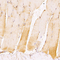 //jororwxhrkinln5q-static.micyjz.com/cloud/ljBpjKnjlkSRqiqpopmrip/1612338225748906409-60-60.jpg
