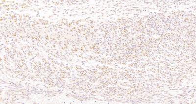 GB121219 Anti -HES3 Mouse Monoclonal Antibody