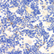 //jororwxhrkinln5q-static.micyjz.com/cloud/lkBpjKnjlkSRqiqpnppkip/d875c21da0c13bb6f5a146ebaaed933d-60-60.jpg