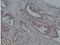 //jororwxhrkinln5q-static.micyjz.com/cloud/llBpjKnjlkSRqipplkrqiq/e51d31b708308ab36ac7d26d1b2a18ea-60-60.png
