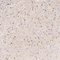 //jororwxhrkinln5q-static.micyjz.com/cloud/lmBpjKnjlkSRqiqpimloiq/695e1d9a2874c601a0ca67e1ab0779d8-60-60.jpg