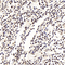 //jororwxhrkinln5q-static.micyjz.com/cloud/lmBpjKnjlkSRqiqpppopip/8710ab88b859ee1555312315471d4909-60-60.jpg