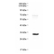 //jororwxhrkinln5q-static.micyjz.com/cloud/lnBpjKnjlkSRqippqjiniq/87ec94a95d819c58a5655b957d026315-60-60.jpg