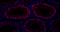 //jororwxhrkinln5q-static.micyjz.com/cloud/lnBpjKnjlkSRqiqpnkpriq/1595315614988531564-Rgaowan-5-CSTF2T-IF-6319-1-700-_25-6x-60-60.jpg
