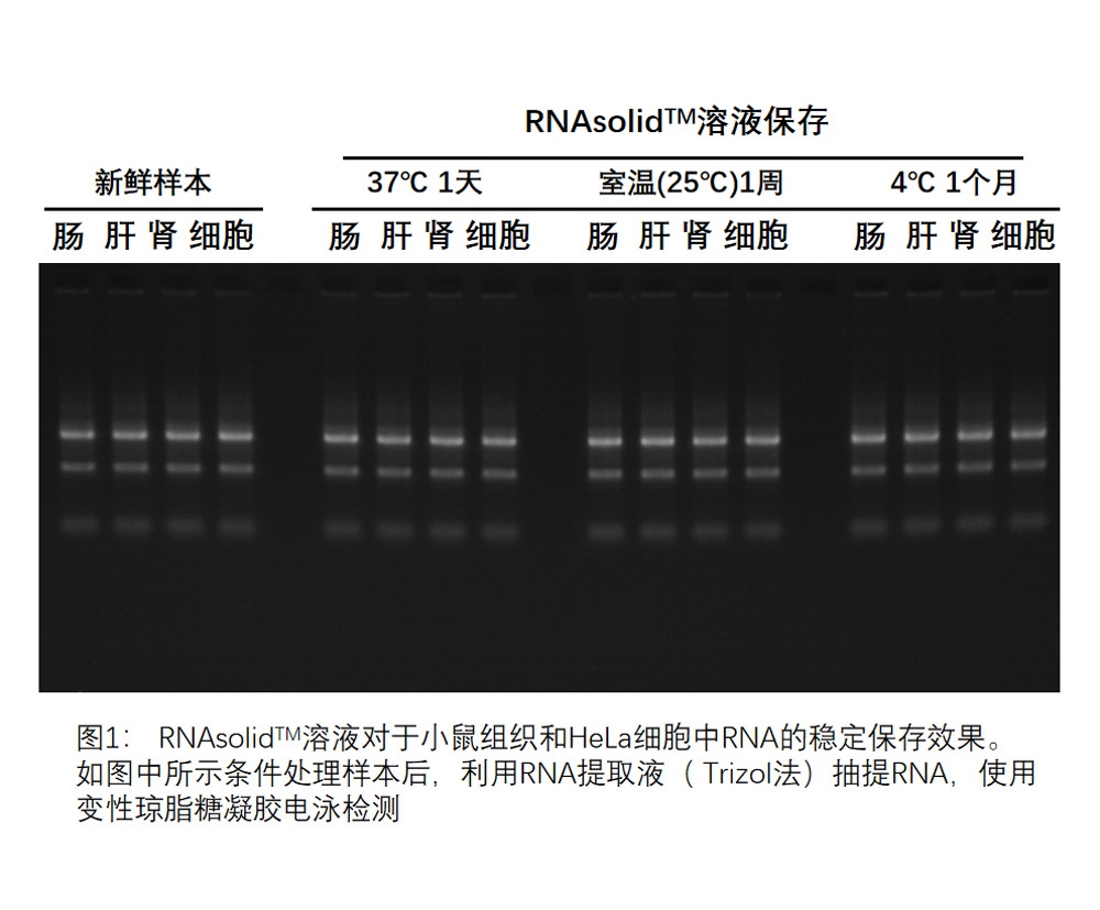 RNA solid tissue RNA stable preservation solution for Nucleic acid extraction reagent