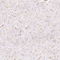 //jororwxhrkinln5q-static.micyjz.com/cloud/loBpjKnjlkSRqikppprniq/6a02bdc5c49b2f39bb6f08a790cecb21-60-60.jpg