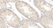 //jororwxhrkinln5q-static.micyjz.com/cloud/loBpjKnjlkSRqiqplkjpiq/1595311560724379864-6295-SCP1-dashugaowan-1-1300_29-6x-60-60.jpg