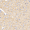 //jororwxhrkinln5q-static.micyjz.com/cloud/loBpjKnjlkSRqiqplonjiq/d84af42e39a86eb8a37ae3e4cae886a2-60-60.jpg