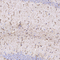 //jororwxhrkinln5q-static.micyjz.com/cloud/lpBpjKnjlkSRqippmiiqiq/f7194810b4d7ac88daf5b76e1daf3437-60-60.jpg
