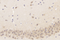 //jororwxhrkinln5q-static.micyjz.com/cloud/lrBpjKnjlkSRpirlirjpio/GB11523-60-60.png
